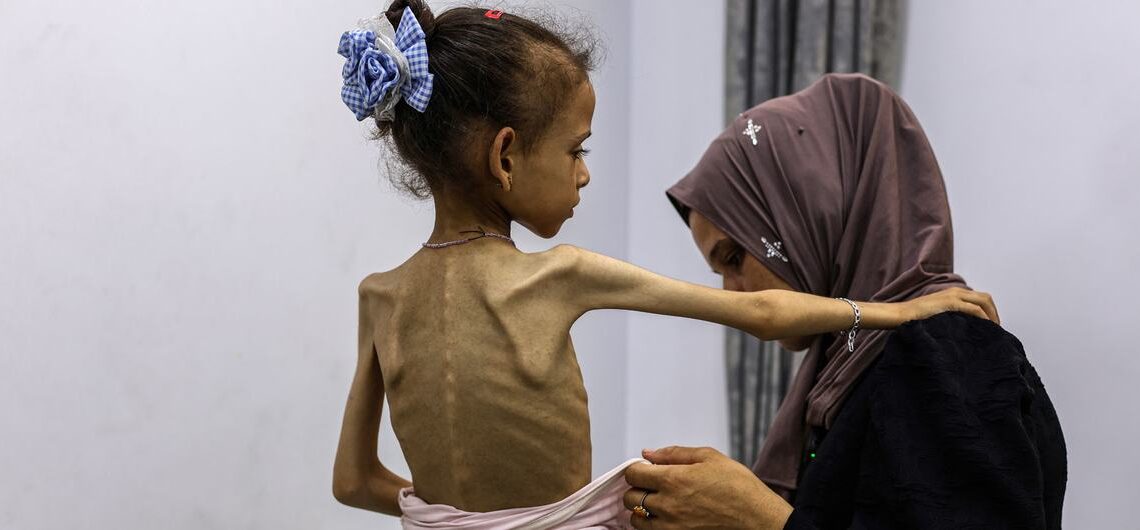 Global Outcry as UN-Backed Report Declares Famine in Gaza