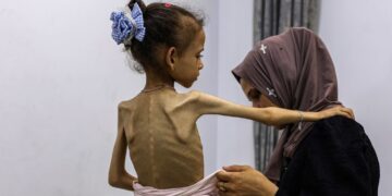 Global Outcry as UN-Backed Report Declares Famine in Gaza