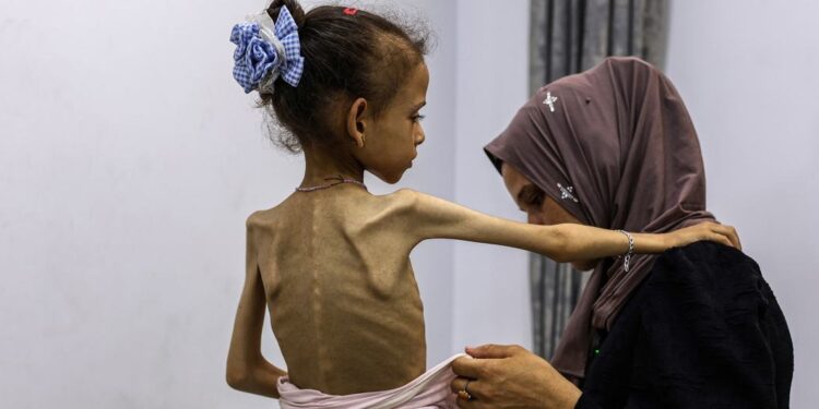 Global Outcry as UN-Backed Report Declares Famine in Gaza